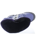 Foot problems special snow boots for girls 
