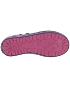 Left ankle turning in toddler fix shoes