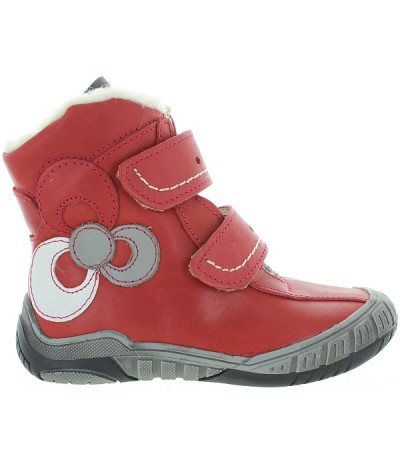Deformed feet in girls best corrective red snow boots