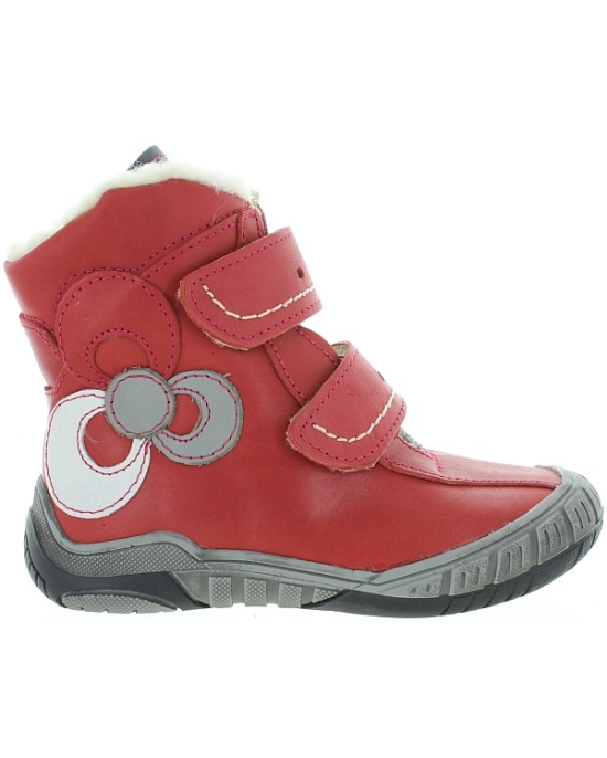 Deformed feet in girls best corrective red snow boots