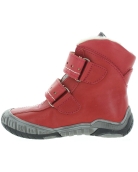 Deformed feet in girls best corrective red snow boots