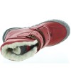 Deformed feet in girls best corrective red snow boots