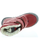 Deformed feet in girls best corrective red snow boots