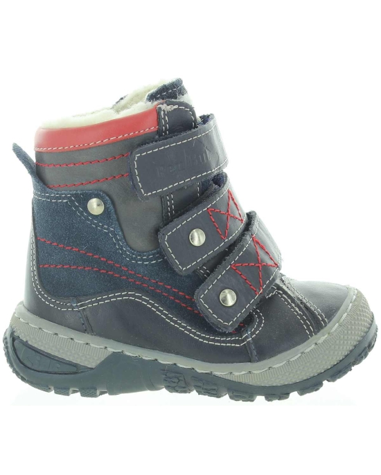 Pigeon toe best shoes for a child 