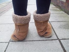 Kids boots UGGS cause ankle pronation