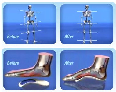 Posture supported by orthodics for kids
